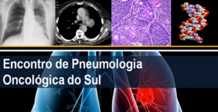 6.º Encontro de Pneumologia Oncológica do Sul: consulte o programa científico