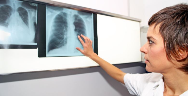 Avanço na hipertensão pulmonar: novo terapêutica reduz risco de agravamento