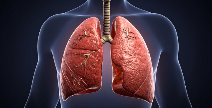 Tuberculose: Especialistas portuguesas integram painel em defesa de um rastreio uniformizado em migrantes